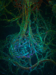 Bacterial IgA1 Protease Cleavage of Secretory IgA on the Mucosal Surface
