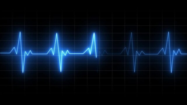 blue color neon line electrocardiogram animation. Neon ECG line animation video on black grid background. Heart beat. One pulse line.  Heart beating and pumping
