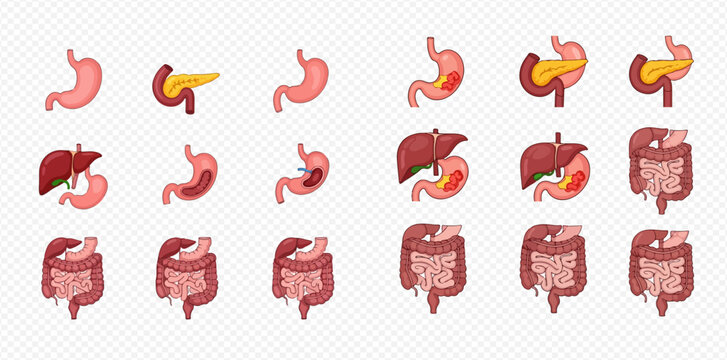 Set of human internal organs showing healthy and diseased states, including stomach, liver, pancreas, and intestines.
