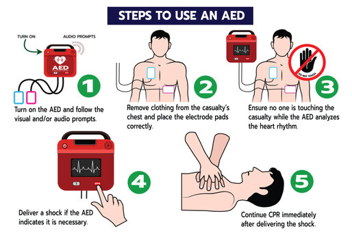 Clear vector illustration explaining how to use an automated external defibrillator (AED) in emergency situations. Suitable for safety training, first aid education, and medical awareness materials
