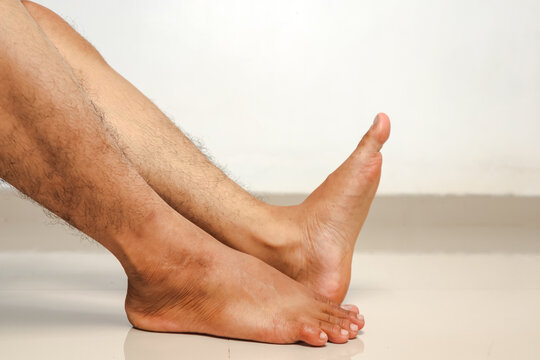 Man's hairy legs and feet resting on a white floor, isolated against a white background.