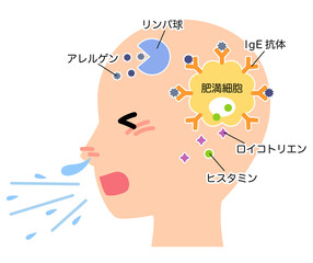 アレルギー発症のしくみ　花粉症のメカニズム