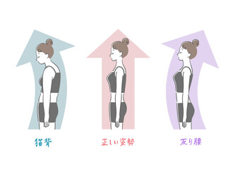 正しい姿勢と猫背と反り腰の女性の比較イラストセット