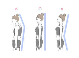 猫背と反り腰と正しい姿勢の女性の比較イラストセット