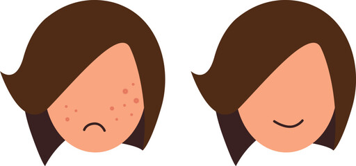 Flat Style Vector Illustration of Girl Faces Showing Acne Transformation