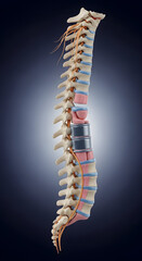 A detailed anatomical illustration of the human spine. It features vertebrae, spinal nerves, and two metallic artificial discs replacing natural ones in the lower back.

