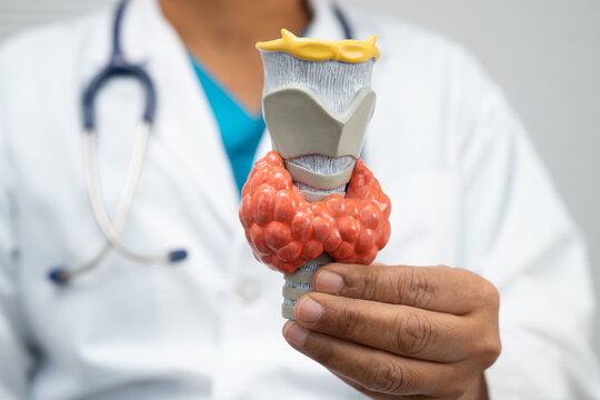 Hyperthyroidism, Overactive Thyroid, Thyroid Lymphoma, Asian doctor with thyroid gland human anatomy model in hospital.