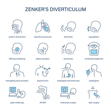 Zenker's Diverticulum symptoms, diagnostic and treatment vector icon set