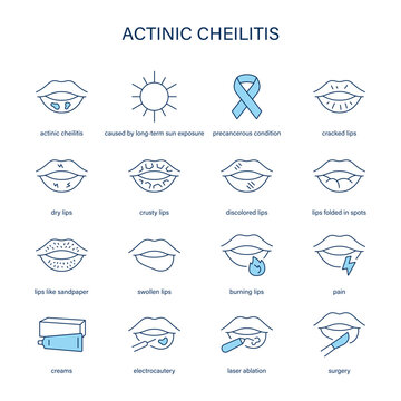 Actinic Cheilitis symptoms, diagnostic and treatment vector icon set