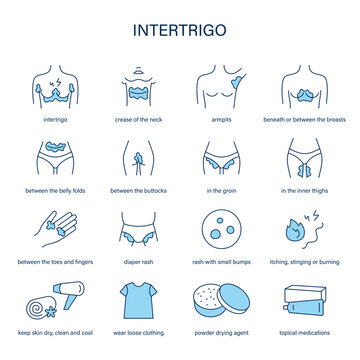 Intertrigo symptoms, diagnostic and treatment vector icon set