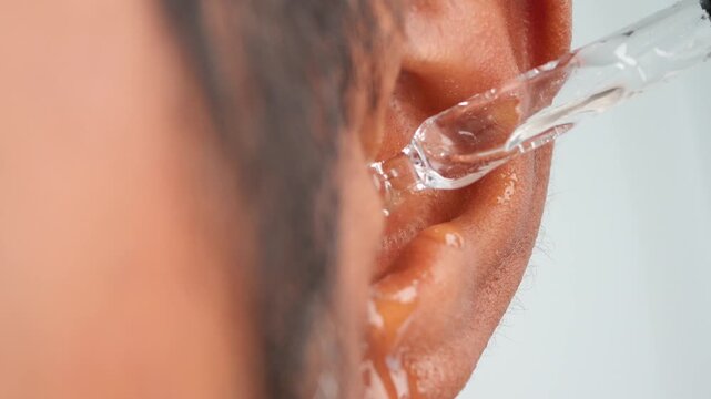 Close up shot of liquid being dropped into ear canal for ear care and treatment motion