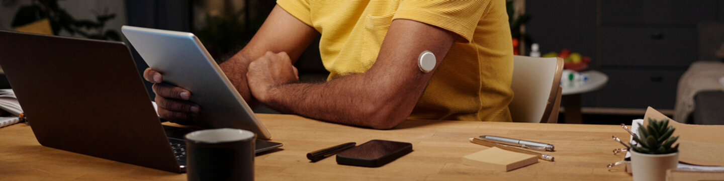 Man at home workspace using digital devices with insulin patch on arm