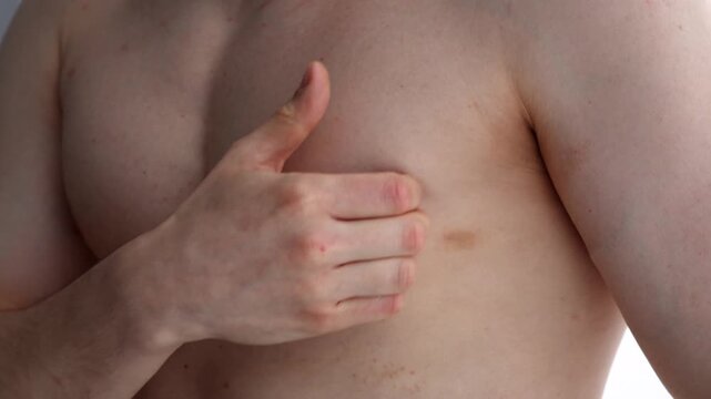Ringworm on the skin.
Close-up of an allergic rash on a man's body.
Red pimples on the body.