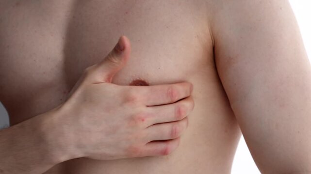 Skin psoriasis on the body.
Itchy skin due to allergies.
Close-up of ringworm on the body.