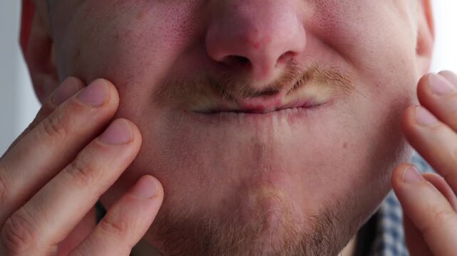 A man puffs out his cheeks while holding his breath.
Air in the mouth.
Large cheeks on the face.