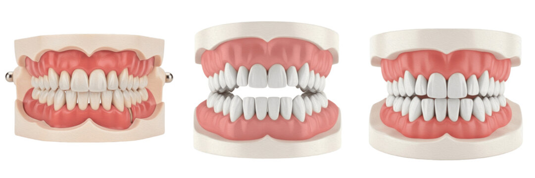 Upper human jaw with teeth isolated on white background, maxilla anatomy close up, realistic dentition and gum structure, dental arch model, orthodontic reference, dentistry and oral anatomy education