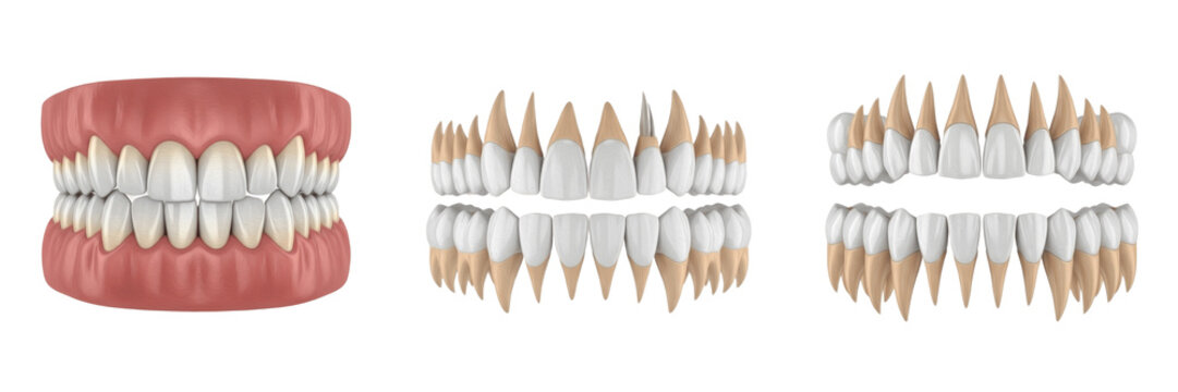 3D model of human teeth isolated on white background, realistic dental anatomy rendering showing tooth crown roots and gums, orthodontic and dentistry education model for dental clinic presentations