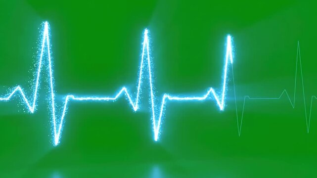 Green Screen 3d render of a heartbeat frequency on cardiograph recording pulse scene 4 with distortion, overlay, glitch, static noise, scan lines black background, 4k animated video loop