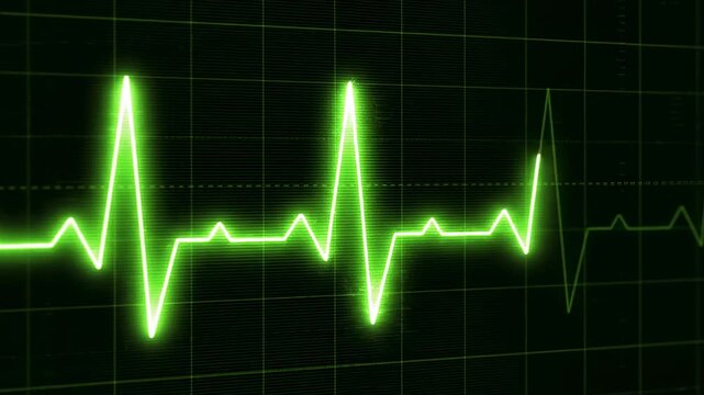 Close-up of a green ECG heartbeat line on a black grid background with a medical theme.