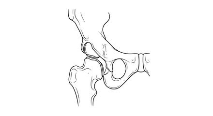 Anatomical illustration of a healthy human hip joint, showing the femur head fitting into the acetabulum.