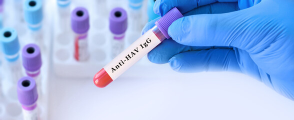 Fototapeta premium Doctor holding anti HAV IgG blood test tube explaining long term immunity to hepatitis A, past infection or vaccination status assessment in clinical laboratory diagnostics