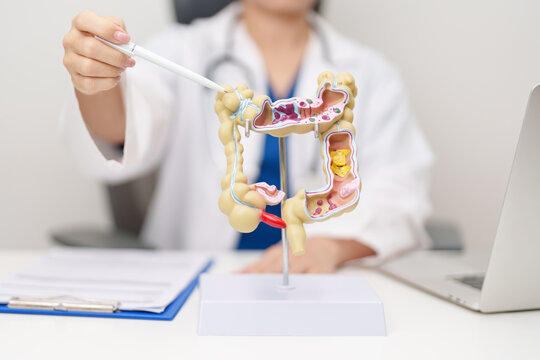 Doctor with human Colon anatomy model. Colonic disease, Large Intestine, Colorectal cancer, Ulcerative colitis, Diverticulitis, Irritable bowel syndrome, Digestive system and Healthcare concept