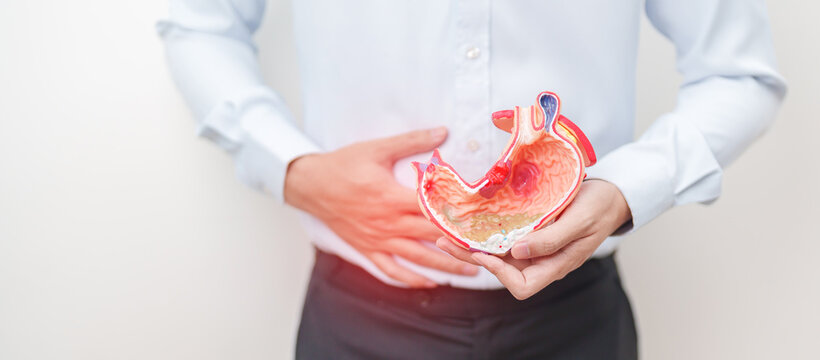 Man having abdomen pain or Stomachache with Gastric anatomy model. stomach diseases and ulcers, Gastroesophageal Reflux, November stomach cancer, Gastroenterologist consultation and Acid reflux
