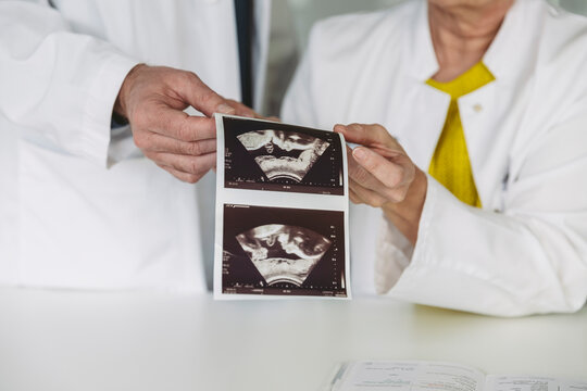 Two doctors holding ultrasound images of fetus