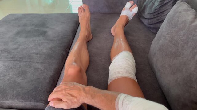 Close-up view of an injured arm and leg with bandage while a man rests on a couch, representing recovery, healing, healthcare, and post-accident rest at home