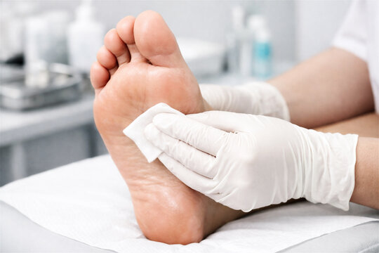 professional podiatrist in protective gloves cleaning a human foot with a cotton pad performing a medical procedure for foot care health and hygiene in a medical office setting