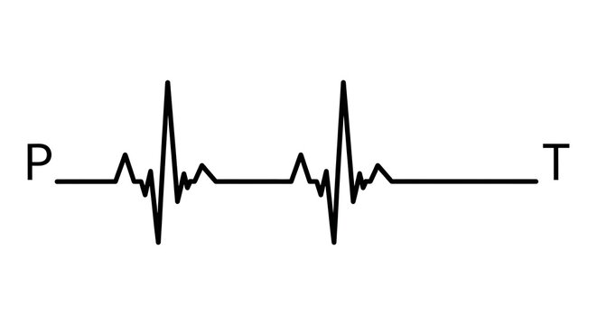 Electrocardiogram waveform showing p wave qrs complex and t wave in detail