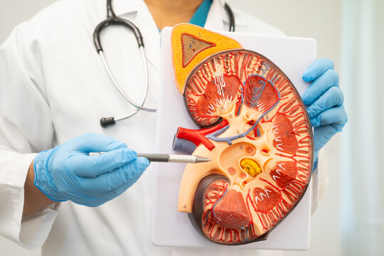 Chronic kidney disease, doctor with model for treatment urinary system, urology, Estimated glomerular filtration rate eGFR.
