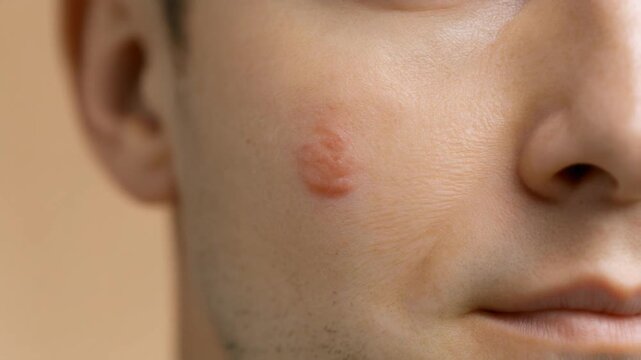 Close up of fair skin with a blemish that blends into a natural and healthy appearance in a simple setting