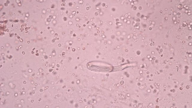 View in microscopic Strongyloides stercoralis or threadworm in human stool.Parasite or fluke infection.Medical background analyze by microscope, original magnification 400x