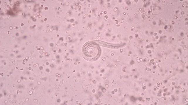 View in microscopic Strongyloides stercoralis or threadworm in human stool.Parasite or fluke infection.Medical background analyze by microscope, original magnification 400x