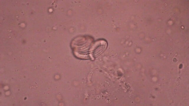 View in microscopic Strongyloides stercoralis or threadworm in human stool.Parasite or fluke infection.Medical background analyze by microscope, original magnification 400x
