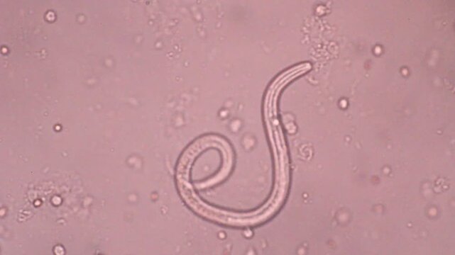 View in microscopic Strongyloides stercoralis or threadworm in human stool.Parasite or fluke infection.Medical background analyze by microscope, original magnification 400x