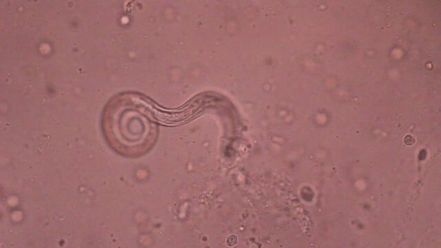 View in microscopic Strongyloides stercoralis or threadworm in human stool.Parasite or fluke infection.Medical background analyze by microscope, original magnification 400x