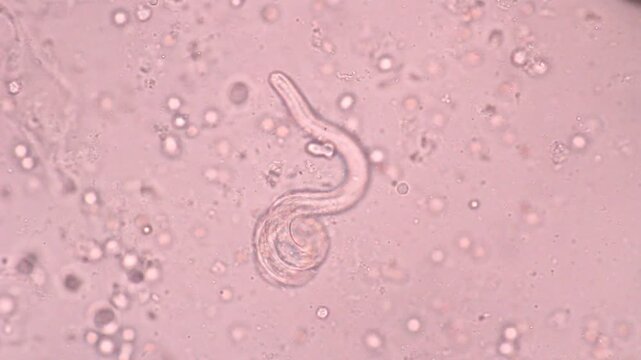 View in microscopic Strongyloides stercoralis or threadworm in human stool.Parasite or fluke infection.Medical background analyze by microscope, original magnification 400x