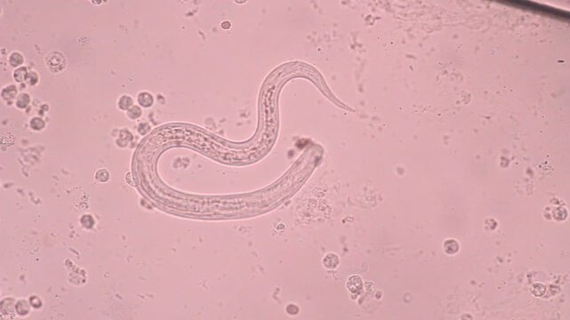 View in microscopic Strongyloides stercoralis or threadworm in human stool.Parasite or fluke infection.Medical background analyze by microscope, original magnification 400x