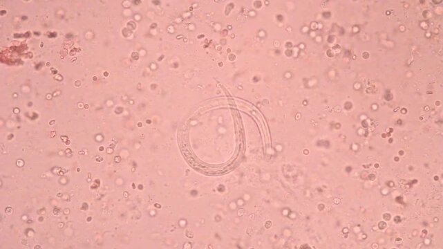 View in microscopic Strongyloides stercoralis or threadworm in human stool.Parasite or fluke infection.Medical background analyze by microscope, original magnification 400x