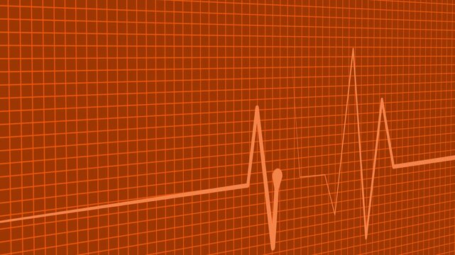 Electrocardiogram heartbeat wave signal animation on grid background