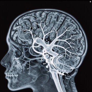 kawaii, enhanced brain x-ray illustration highlighting neural pathways for neurology research