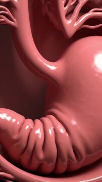 3D Medical Animation Demonstrating Gastric Bezoar Formation and Its Impact on the Stomach Digestive System