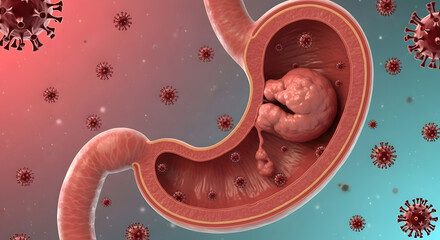 Detailed anatomical view of a human stomach with an internal tumor and viral invasion