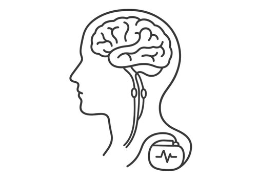 A minimalist line art illustration of a human head in profile showing the brain and a medical implant device with wires connected to the nervous system for deep brain stimulation.