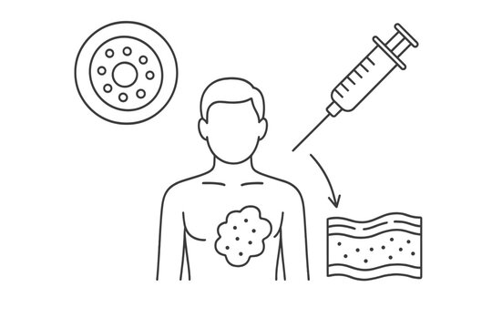 A black and white line art illustration depicting a human torso with a skin lesion, a petri dish, a medical syringe, and a cross-section of skin layers for medical research.