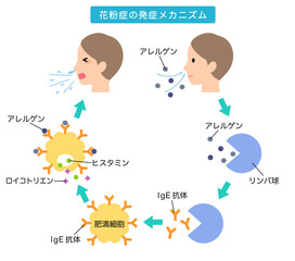 アレルギー発症のしくみ　花粉症のメカニズム