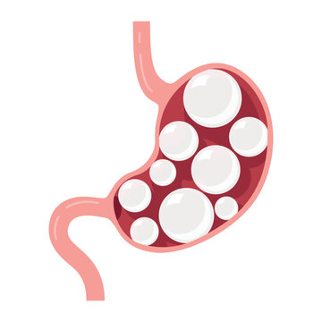 An illustration of a stomach with bubbles, demonstrating bloating, heaviness, or gas issues. Concept of an unhealthy digestive system, with discomfort and pain.