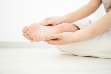 Naklejka premium Close up of peeling and cracked foot. Causes of peeling foot included fungal infection (athlete's foot), dermatitis (eczema), sunburn, dry skin, dehydration or sweaty feet. Health care concept.